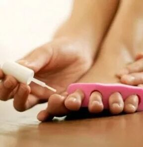 Zastosowanie lakieru terapeutycznego