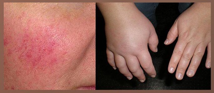 Skutki uboczne kropli